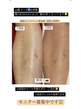 ルミエール(LUMIERU)/