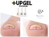 最新【巻き爪ケア】UP GEL　【親指以外のお爪】1本巻き爪ケア¥6000(¥6600)