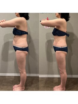 タイコボディラボ 桜山店(TAICO BODY LABO)/骨盤矯正+フォースカッター