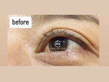 アイアンド(i&)/マイラミ　施術前