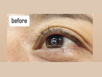 アイアンド(i&)/マイラミ　施術前