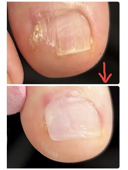 エンヴィ(ENVY)/お爪は作れるんです♪