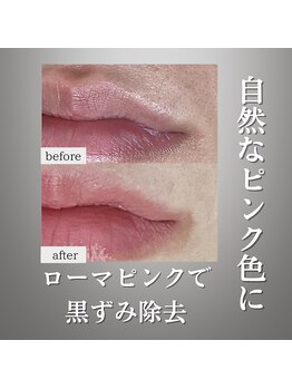 サロン ド ナース ユー ソナ(salon de nurse U.sona)/ローマピンクでピンクリップを！