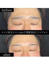 ユー 千葉駅前店(you)/ビフォ－アフター写真