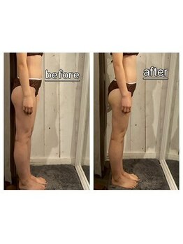 リラル(RERAR)/全身リンパ40分