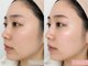 ヴィーナスプロ 岡山駅前(Venus Pro)の写真