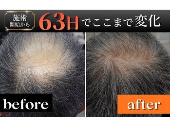 ヴァルク 名古屋店(VA LK)の写真/最新ヒト幹細胞育毛促進で変わる！【気になる頭髪】もドライヘッドスパでリフレッシュ♪至福のひととき