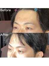 眉毛ハウス 吉祥寺店(眉毛HOUSE)/お客様の施術例(吉祥寺/東京)