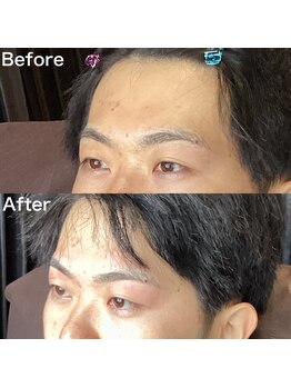 眉毛ハウス 吉祥寺店(眉毛HOUSE)/お客様の施術例(吉祥寺/東京)