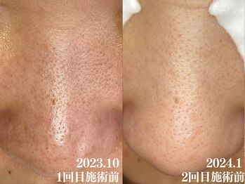 サロン ムスブ(salon MUSUBU)/山梨エステ/甲府エステ