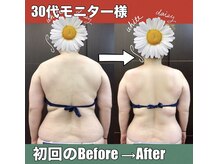 スワン 新栄店(SWAN)/初回のBefore→After/モニター様