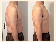 ラフリー 天神赤坂院(RUFFREE)/巻き肩特化型整体【天神赤坂】