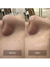 ゴホウビ オキナワ(GOHOBI OKINAWA)/開き、つまり、黒ずみさよなら★