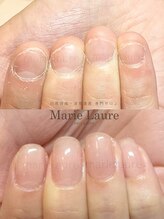 マリーロール 梅田店(Marie Laure)/深爪改善/自爪育成/ネイルケア