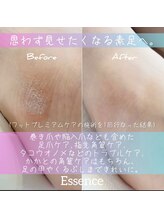 エッセンス (Essence)/フットプレミアムケア