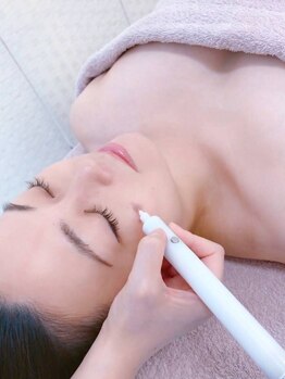 テセラ(Tethere)の写真/【貴方のシミは何年の蓄積シミ】業界で20年以上の実績を持つ機器を導入!ピンポイントでシミにアプローチ◎