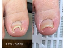 補正もキレイも諦めない！まずはLINE相談をご利用ください