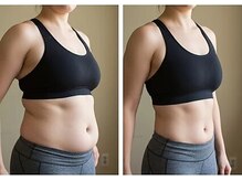 憩いサロン ユリ(yuri)/太もも　お尻 短期集中痩身