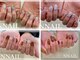 エヌ ネイル(N NAIL)の写真/デザインに迷う方必見!200種類以上のデザイン~選択可能★傷みにくい×持ちが良い◎初めての方も大歓迎◎