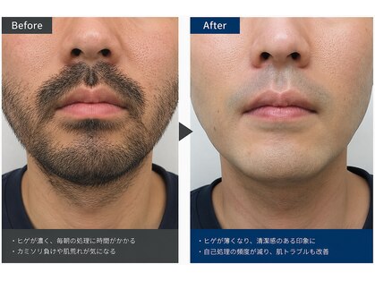 アンドメイル(&male)の写真
