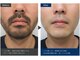 アンドメイル(&male)の写真