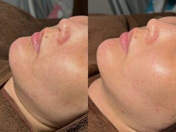 ルーナジェーナ(Luna llena)/池袋 エステ ルーナジェーナ