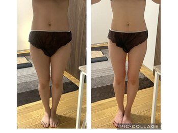 ヨサパーク 指扇店(YOSA PARK)/ 1回でこの効果！