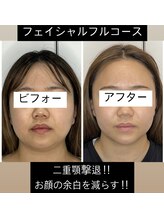 エミナル(EMINARU)/機械でお顔の痩身+小顔矯正