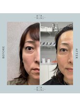 ラプティット(La petite)/40代女性/2回の変化