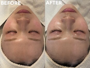 エテルナ(ETERNA)/韓国LDM★水光白玉