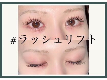 エース アイドット(ACE eye.)の写真