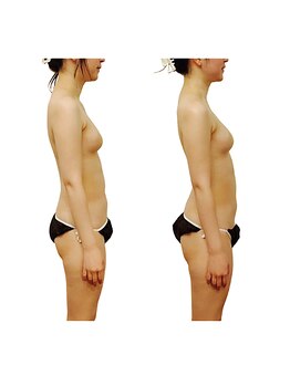 ベンザイ 梅田店(BENZAI)/首、肩こり、バストの下垂