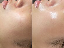 リスト(Rist TOTAL BEAUTY)/LDM