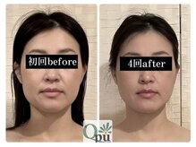 小顔効果だけなく、顔の左右差も均等に！【小顔専門サロン】