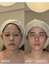 フロル(FLOR)/FLOR 【根本改善専門店】