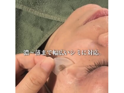 ノーファンデの樹 健康の丘の写真