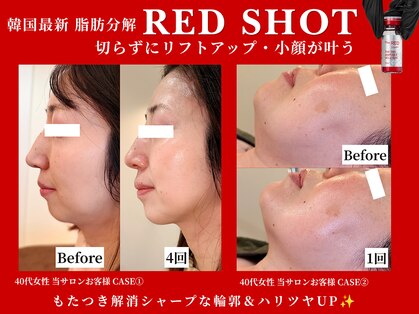 ビーズスタイル(B’S STYLE)の写真