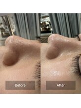 ゴホウビ オキナワ(GOHOBI OKINAWA)/トーンまで変わる♪