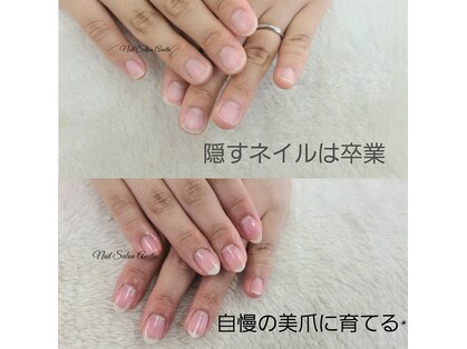 ネイルサロン アミティエ(Nail Salon Amitie)の写真