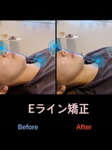 美容矯正サロン レレポノ(LELEPONO)/