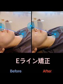 美容矯正サロン レレポノ(LELEPONO)/