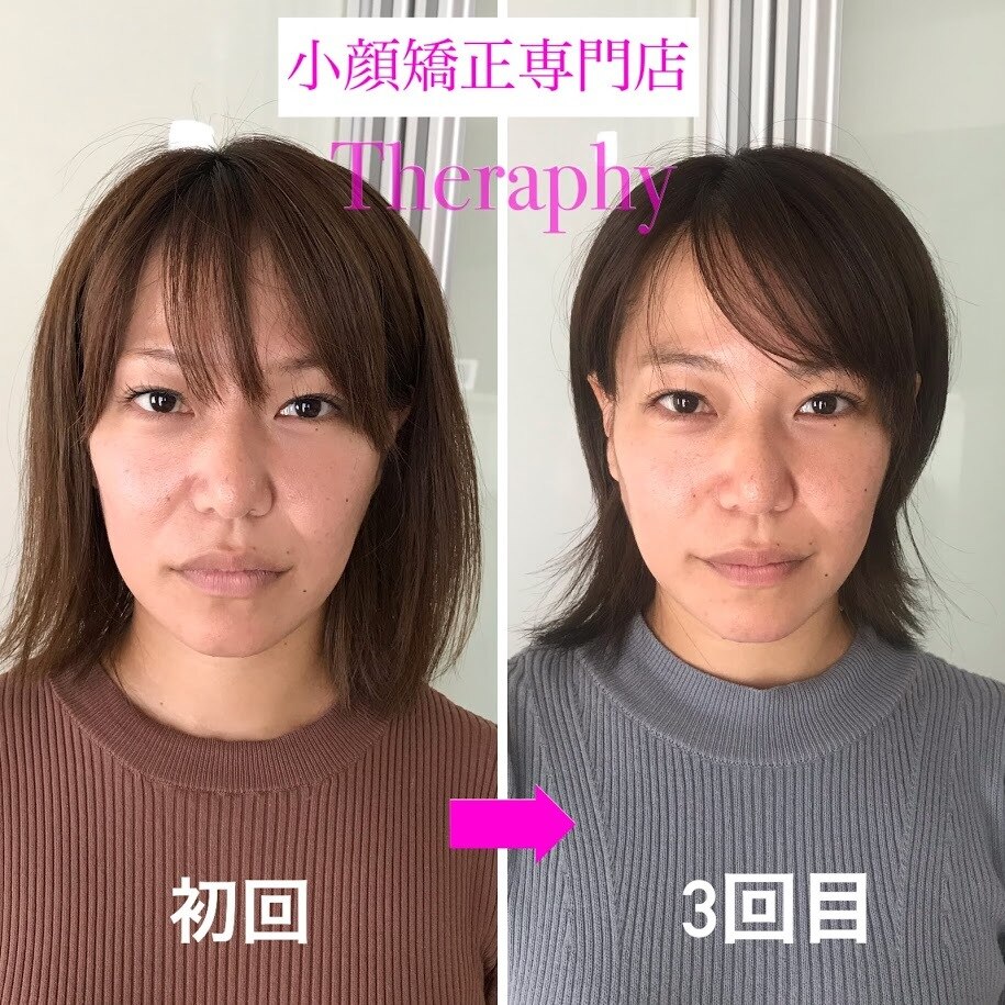 小顔矯正サロン セラフィ｜ホットペッパービューティー