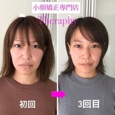 小顔矯正サロン セラフィ