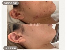 ラシュール(la sur)