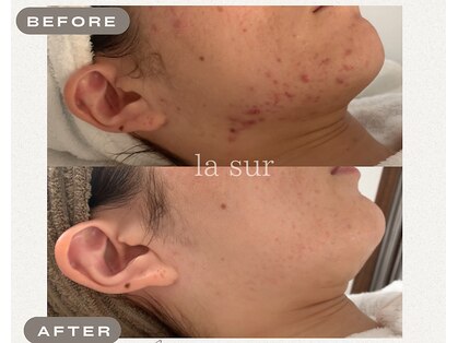 ラシュール(la sur)の写真