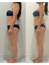 ヴィナーレ(VINARE)/背中の施術に拘ります