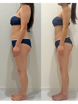 ヴィナーレ(VINARE)/背中の施術に拘ります