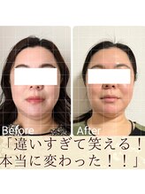 スウ(suu.)/Before-After【40代】12 回