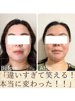 スウ(suu.)/Before-After【40代】12 回
