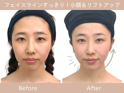 小顔フェイスラボ 梅田茶屋町店(小顔Face Labo.)の写真